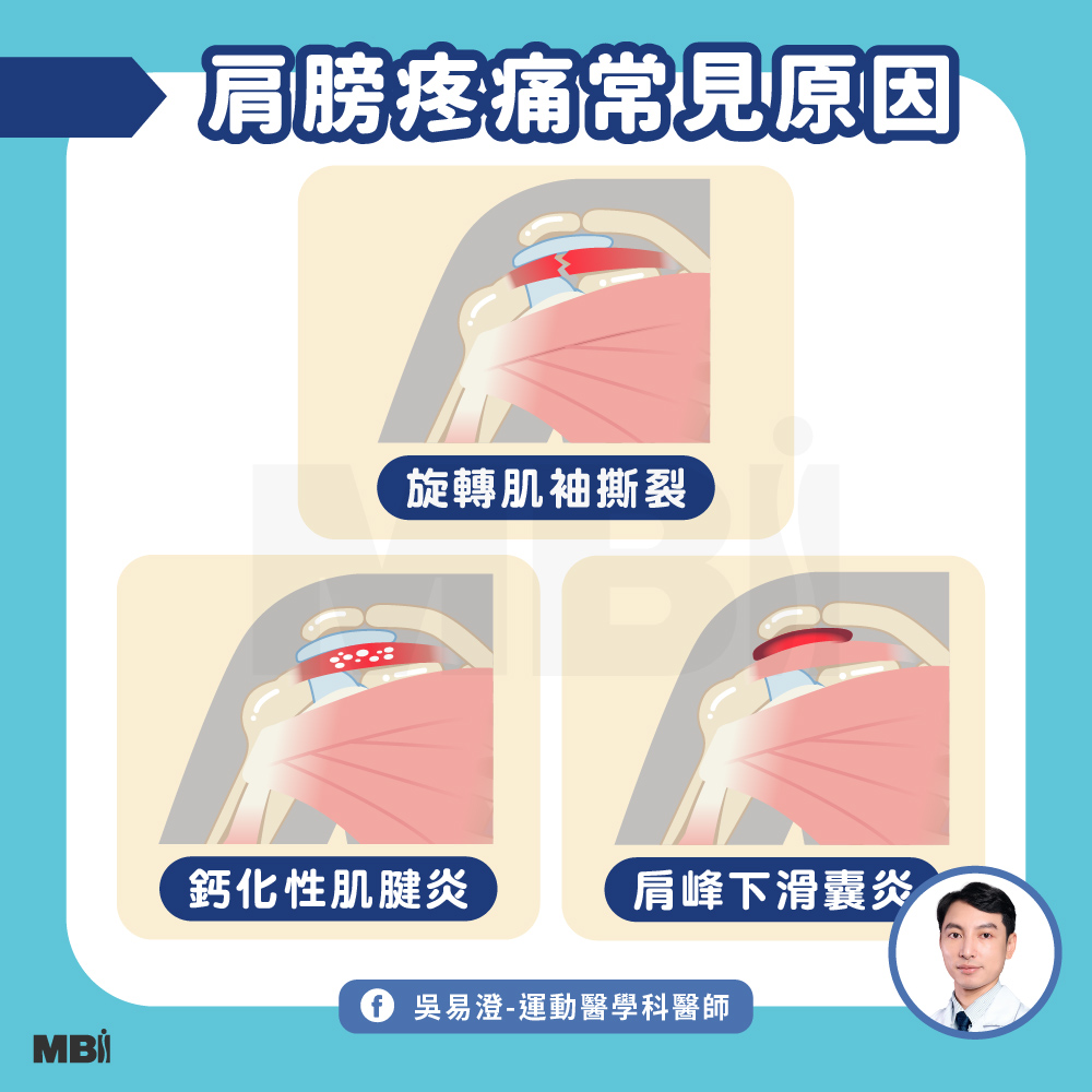 20250626_肩膀疼痛就是五十肩_1000X1000_官網貼文 複本 2