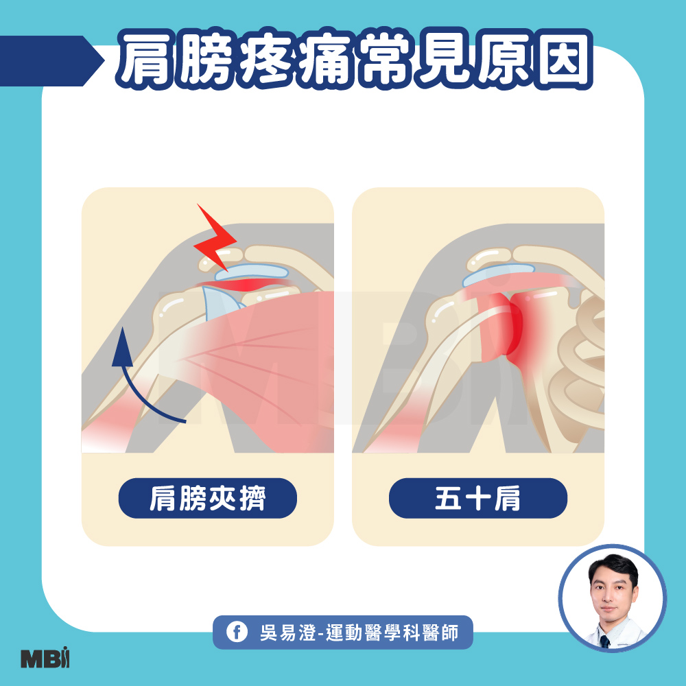 20250626_肩膀疼痛就是五十肩_1000X1000_官網貼文 複本