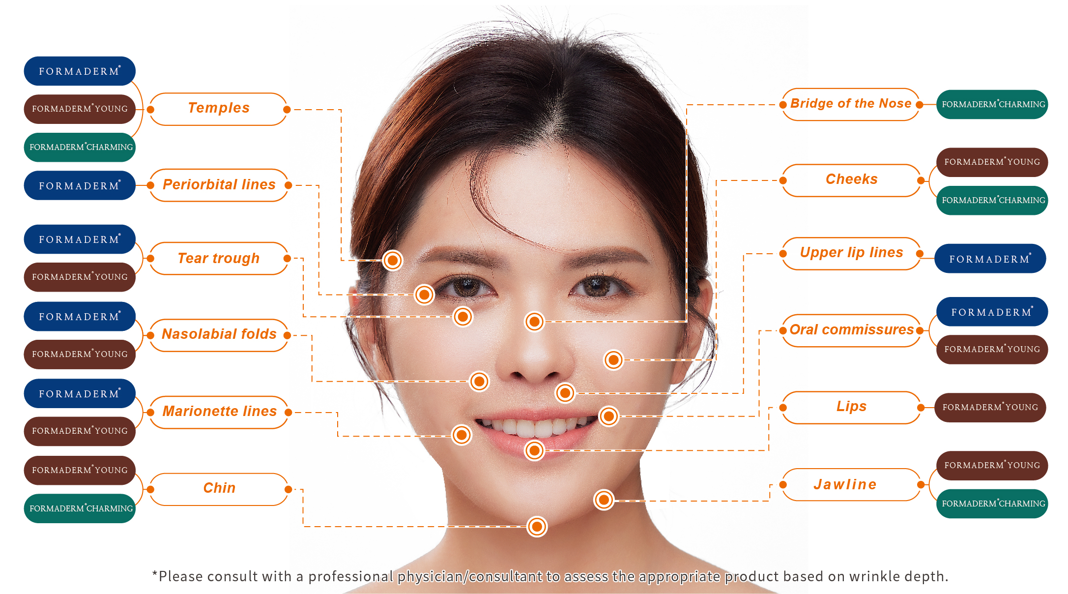 Formaderm dermal filler treatment areas