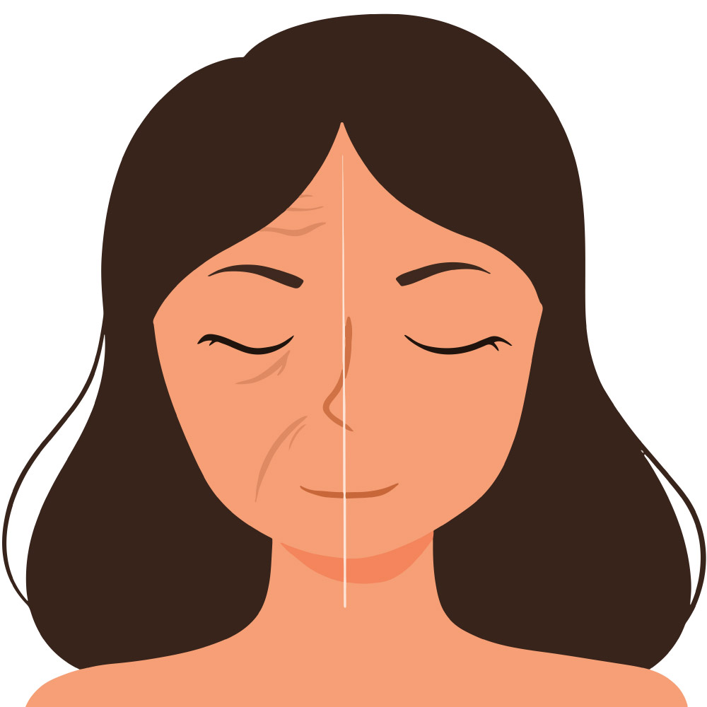 法令紋很深 如何改善或消除